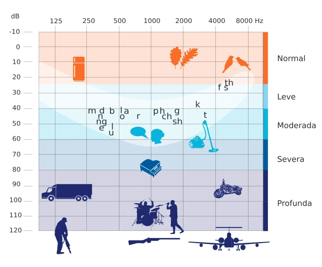 Óptica previsión - Tipos de pérdida Auditiva