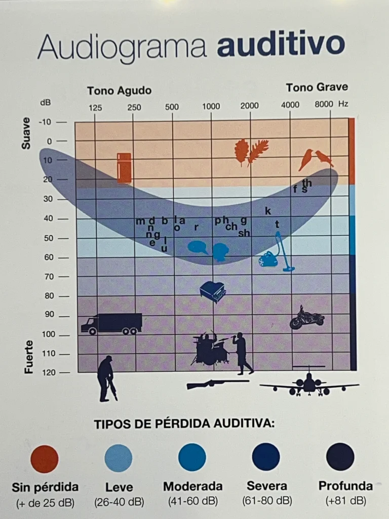 Óptica previsión - TiposPerdidaAuditiva